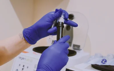 ULTRASOUND GUIDED PRP INJECTIONS